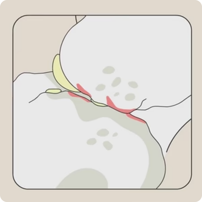 Reduces Inflammation